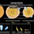 胆固醇代谢的动画讲解/胆固醇与脂蛋白 生化【中英】 Cholesterol Metabolism LDL HDL