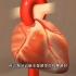 厉害，介入微创心脏冠脉支架植入手术，3D演示。。