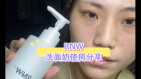 油皮用什么洗脸效果最好 d74248aa02057dd5ef69c9fc1082729205d3910a.jpg@280w_158h_1c_100q.jpg