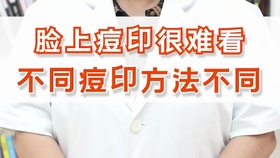 d7941b48126e1583cfa7ef96a4e51921d5887a37.jpg@280w_158h_1c_100q.jpg
