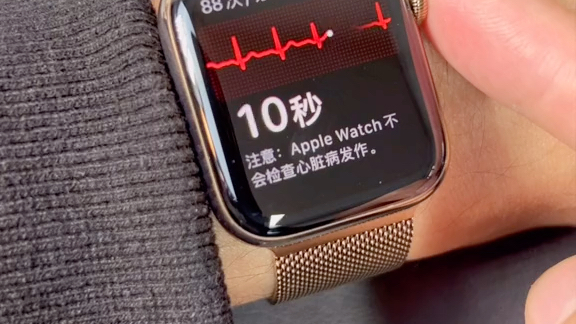Apple Watch检测心电图心率的原理，原来这么小的手表里有这么多东西