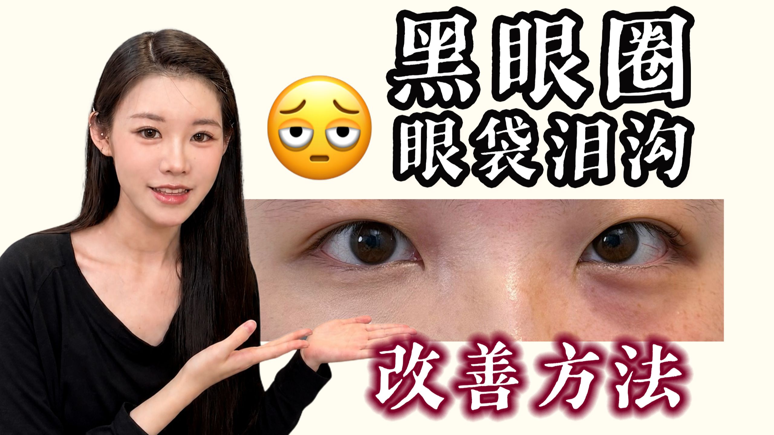 重度黑眼圈、眼袋、泪沟终极改善方法。