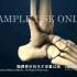脚踝骨折怎么办，手术过程，3D演示。。