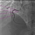 8.心血管影像解剖图谱-冠状动脉造影DSA-右冠状动脉解剖