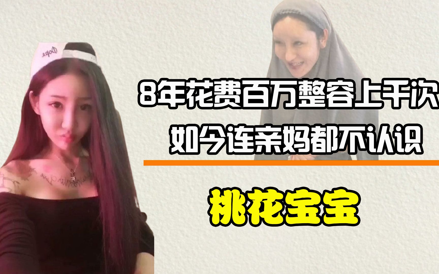 桃花宝宝整容上瘾8年在脸上动刀上千次如今连亲妈都不认识了
