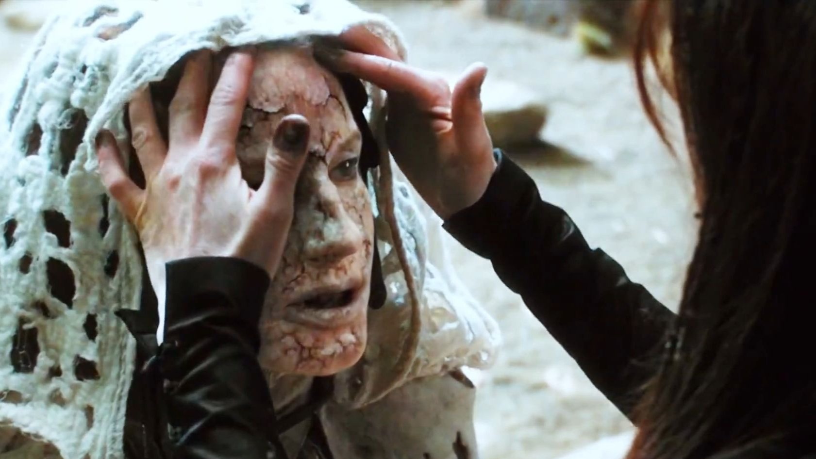 姐姐只是轻轻抚摸了一下这张被严重烧伤的脸，眨眼间就痊愈了《第七子》