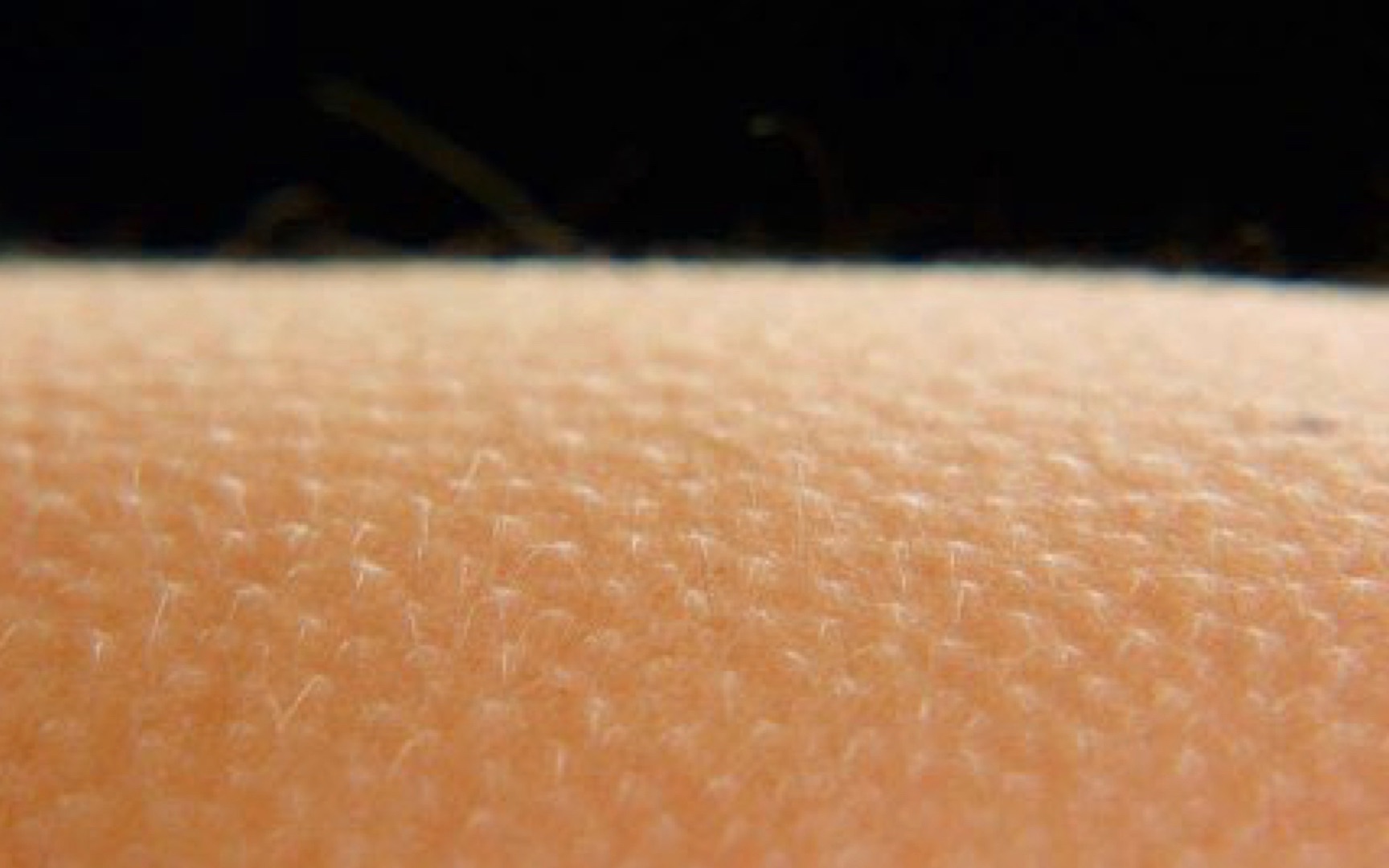 【密集恐惧症慎点】很多人听到美妙的声音会起