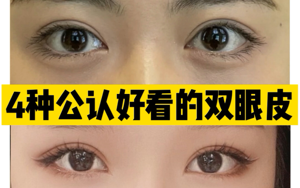 4种公认好看的双眼皮，看看你属于哪一种？