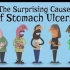 【Ted-ED】胃溃疡的神奇起因 The Surprising Cause Of Stomach Ulcers