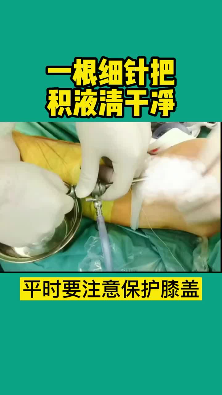 半月板撕裂不治引起的滑膜炎积液