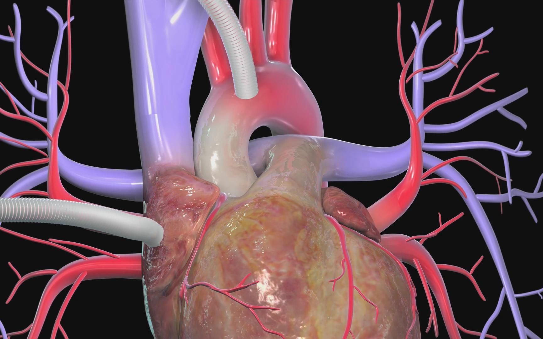 【科普】3d超清演示三种心脏搭桥手术,终于看明白了(乐喷网/心脏病)