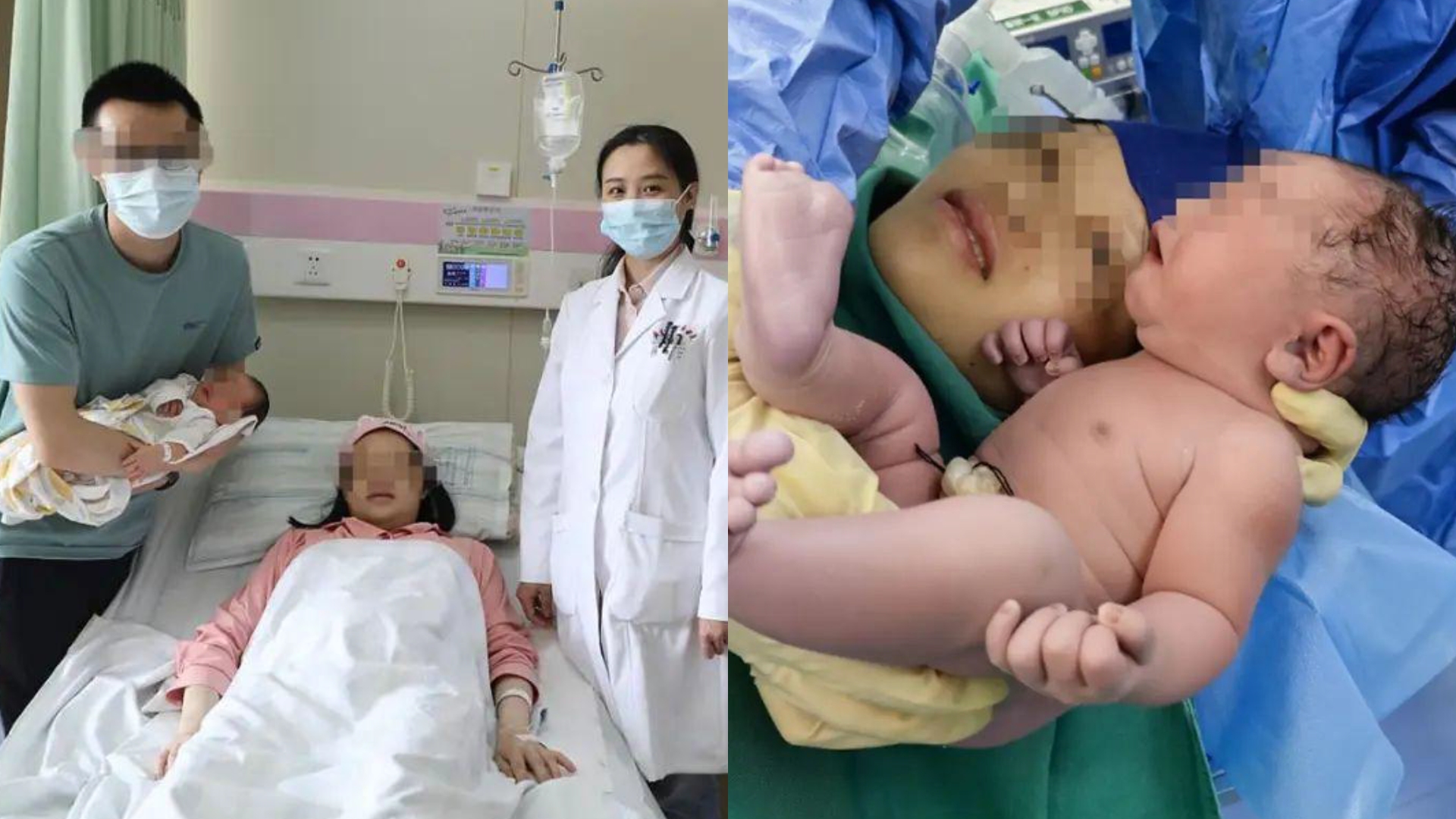 25岁孕妈诞下罕见“镜面宝宝”，出现概率仅百万分之一，医生回应