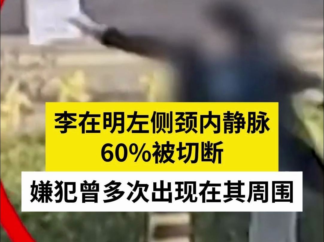 李在明左侧颈内静脉60%被切断，嫌犯曾多次出现在其周围