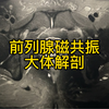 典型前列腺Ca磁共振诊断要点一之前列腺解剖