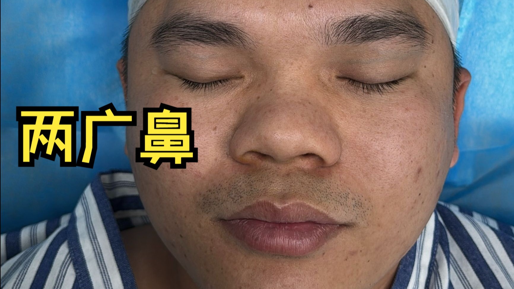 十分典型的两广鼻小哥do完竟然......