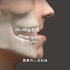 太恐怖了，“地包天”上颌骨前移整容手术过程，3D演示。。