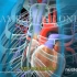 【3D医学动画】主动脉瓣置换（中文字幕+英文字幕）