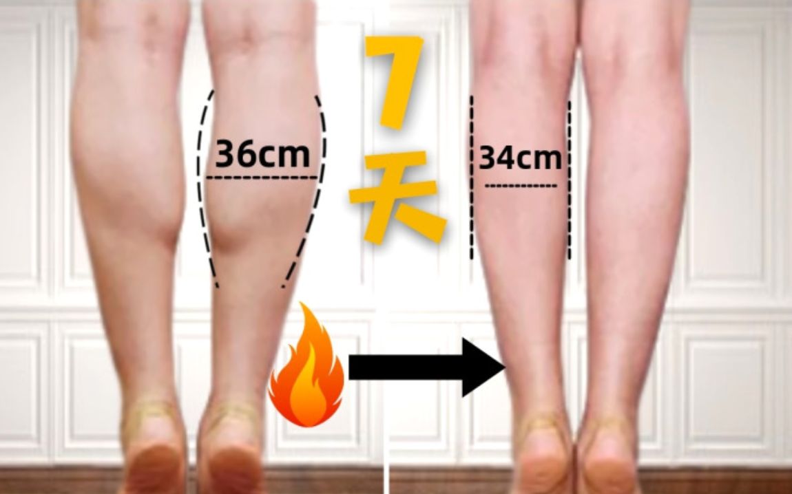 【一周细了2cm】高效瘦小腿运动，肌肉腿和水肿腿必做，亲测有效！