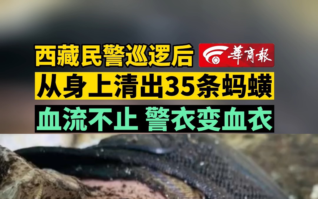 西藏民警巡逻后从身上清出35条蚂蟥 血流不止 警衣变血衣哔哩哔哩bilibili