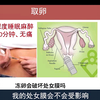 智特医疗张欣博士分享取卵是否会破处女膜