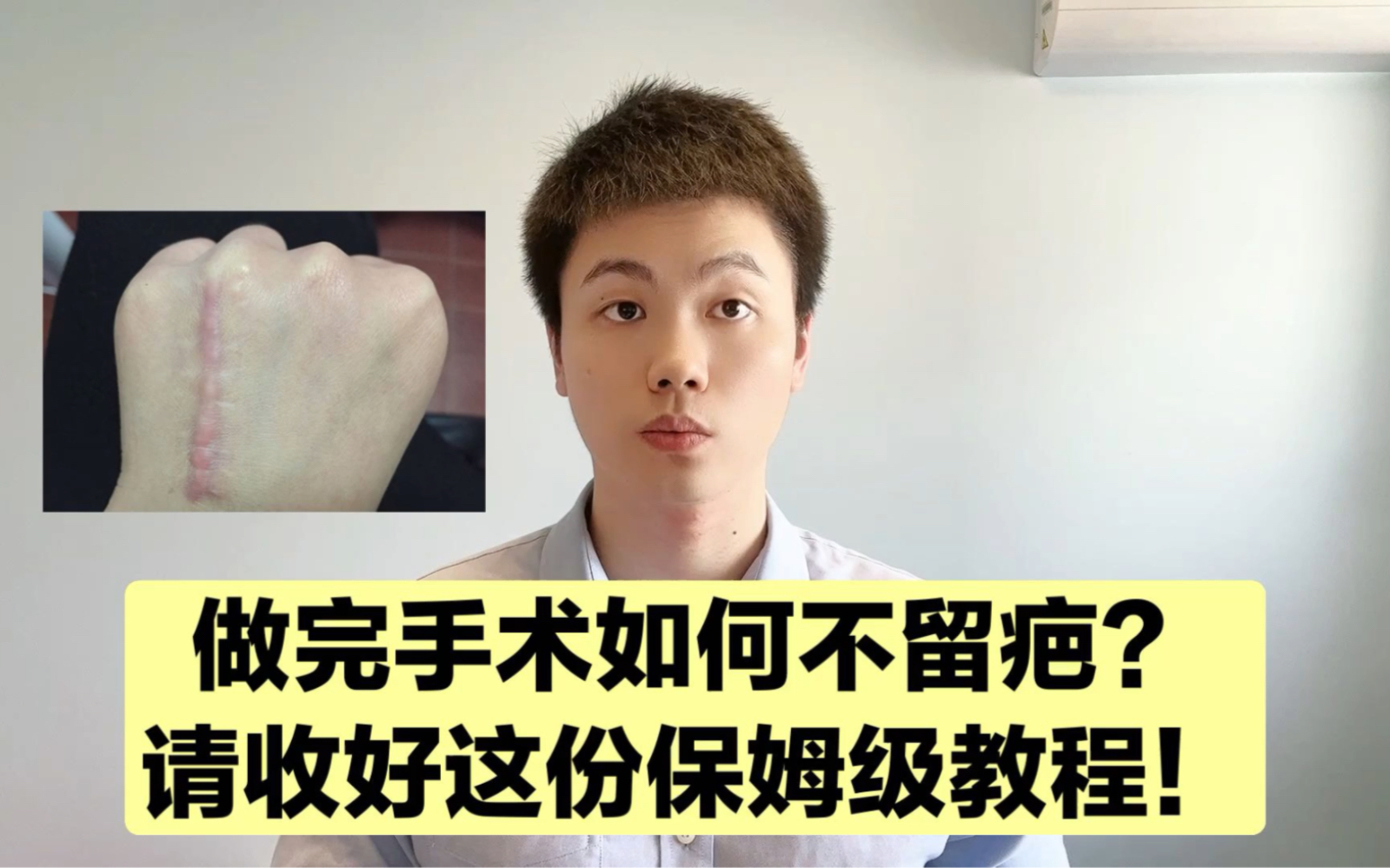 术后如何不留疤？怎么淡化疤痕？很多医生也是一知半解，请收下这份超详细的攻略！
