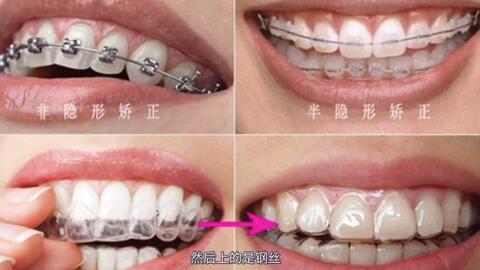 e92381a6925415f76110684680522500d27441ac.jpg@480w_270h_1c