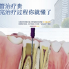 根管治疗贵，看完治疗过程你就懂了—南京根管治疗，推荐你到南京德牙联合口腔医院