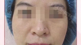 郑州皮肤科医院排名_郑州人民医院图片(2)