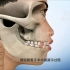 动画模拟磨骨手术过程