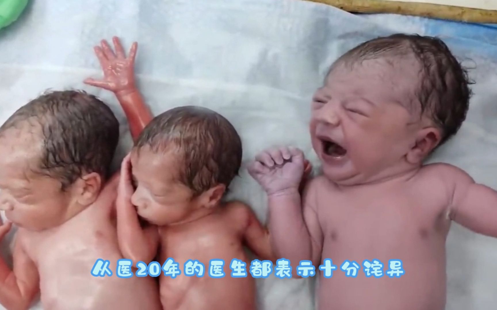 当医生把一个刚出生的宝宝放在这对双胞胎旁边时，他感到震惊