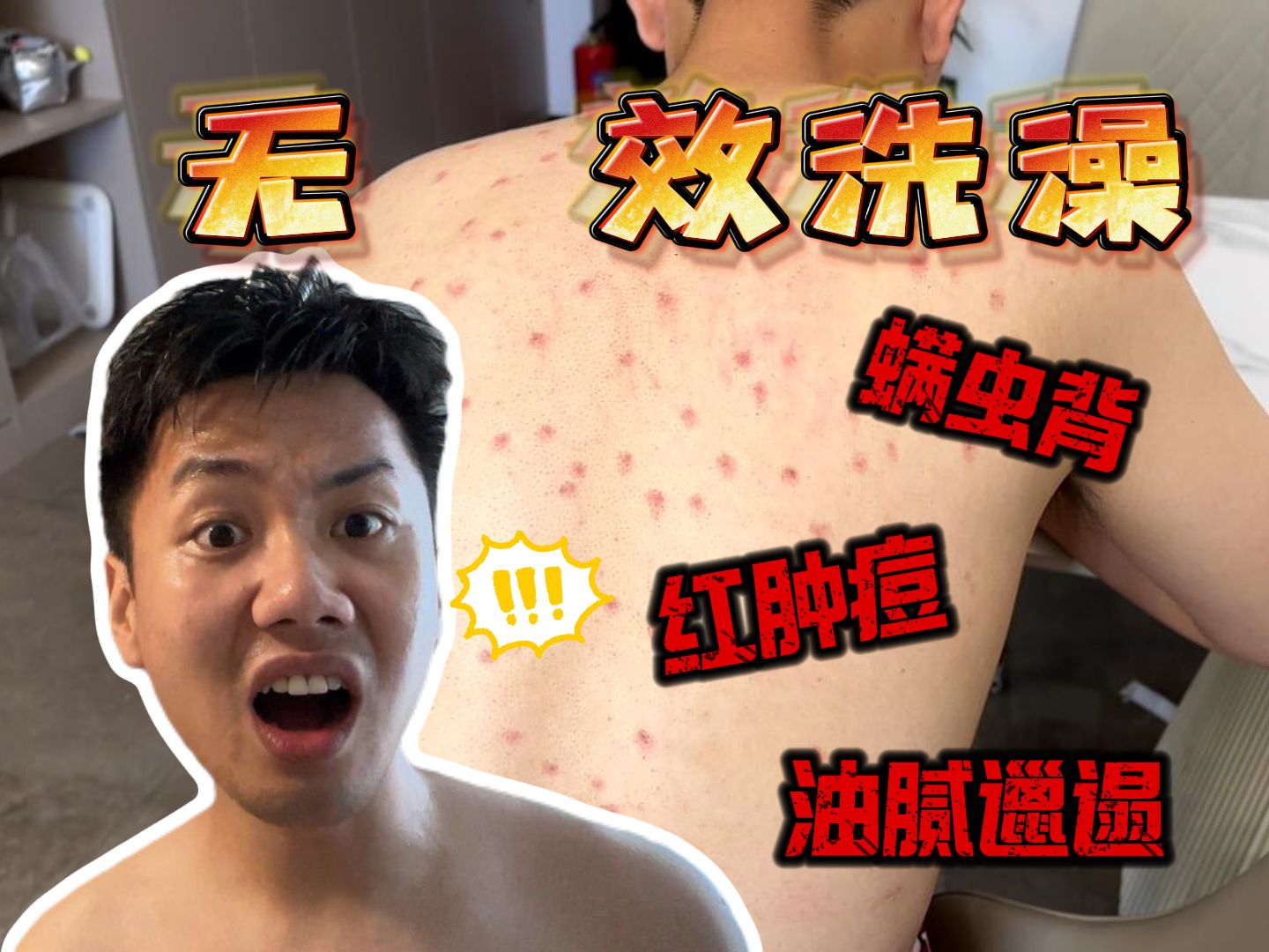 沐浴露能除螨祛痘？实测一个月，我倒要看看怎么个事！！