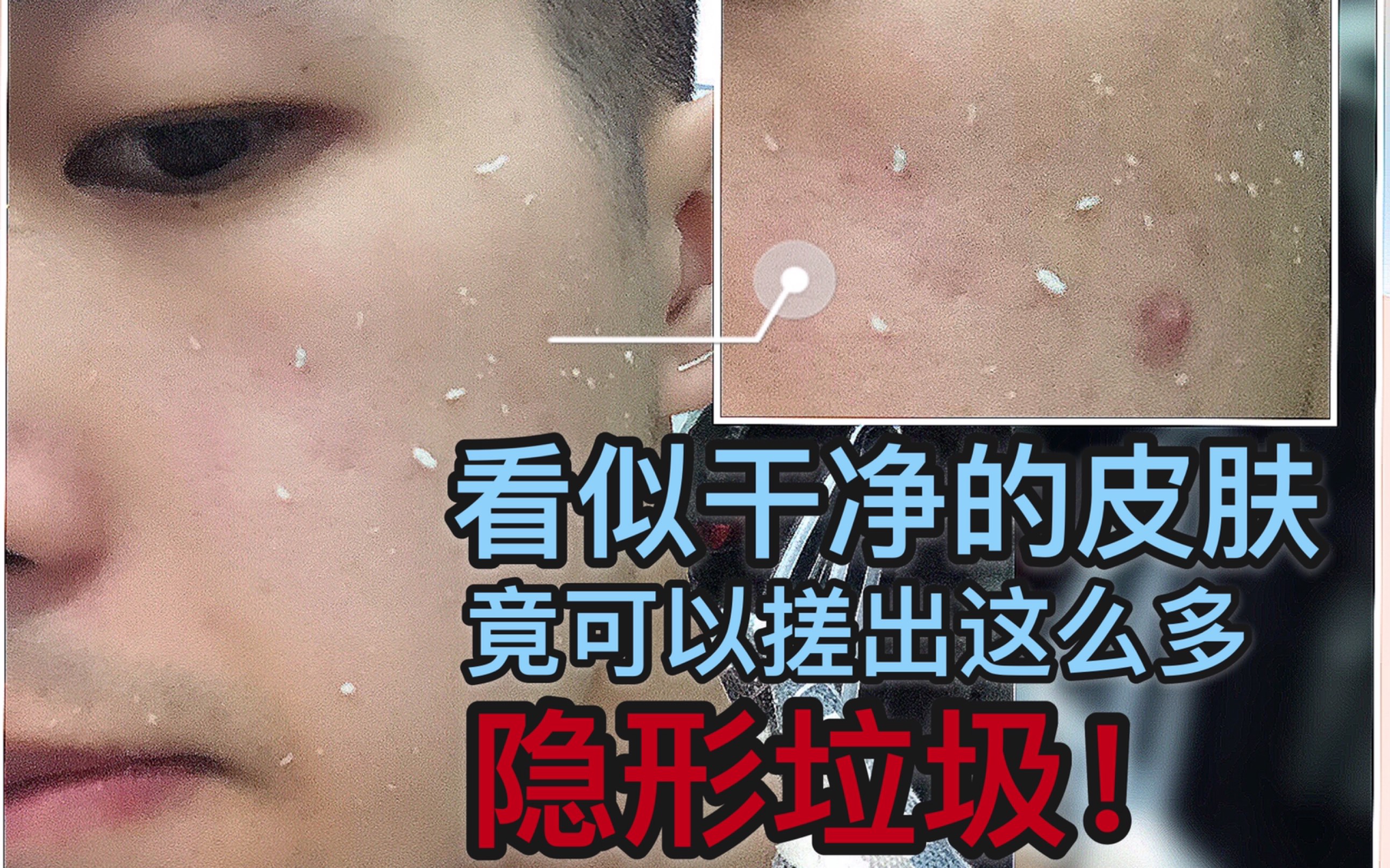 每月一次去老废角质工作-恶心却酸爽-你可知道你的护肤品浪费了多少