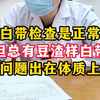 阴道炎总发作，但白带检查却正常，这究竟问题出在哪