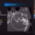 颅底面部影像解剖 Skull Base and face anatomy for Radiologists | Anuj