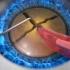 眼睛白内障手术过程，3D演示。。