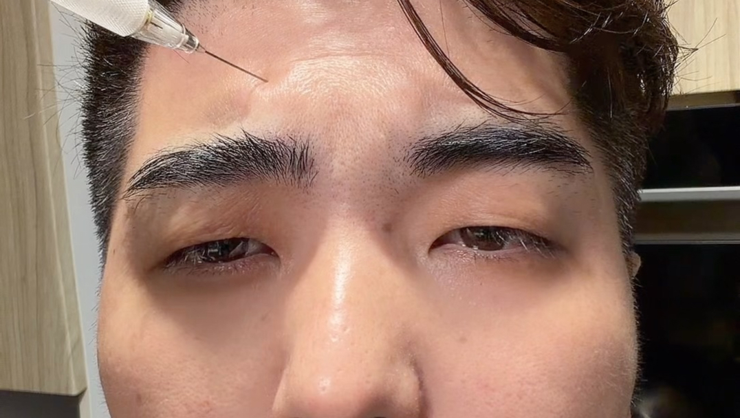 打一针就变帅