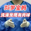 35岁宝妈子宫膨出严重，洗澡时感觉子宫有肉球