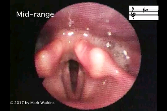 演奏萨克斯超吹口腔内部位置的变化（上低音篇）