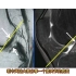 前交叉韧带在MRI上什么表现？撕裂如何诊断？医生讲解！