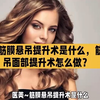 医美~筋膜悬吊提升术是什么，筋膜悬吊面部提升术怎么做