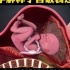 3D医学动画：科学解释子宫破裂过程