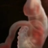 胚胎发育成胎儿的艰难历程