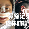 【Jm】超详细鼻综合记录！非科普非科普非科普