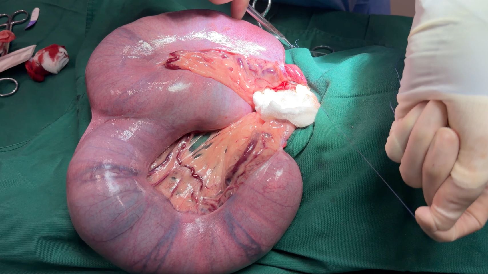 流浪狗难产，子宫增粗 20 倍！