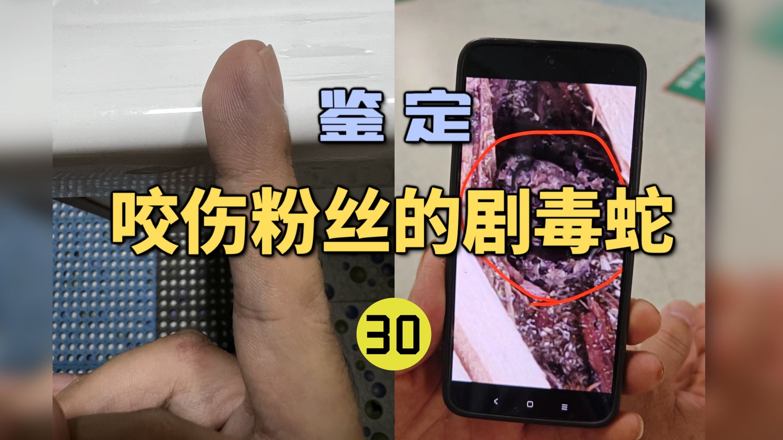 鉴定咬伤粉丝的毒蛇(30)小孩被中国最毒的蝮蛇咬伤！竟然屁事儿没有？