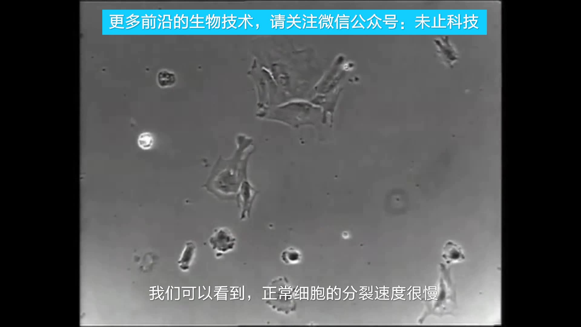 误入洗脑视频再现用高倍显微镜观察癌细胞在人体内的狰狞面目密集恐惧
