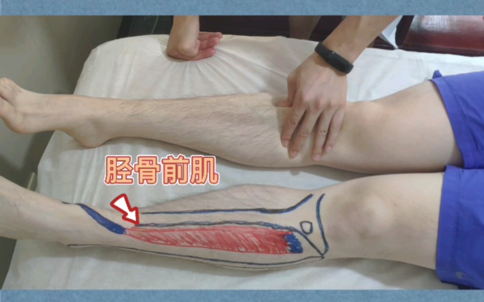 小腿前部肌肉胫骨前肌疼痛的自我放松手法适用于运动后小腿前部酸痛