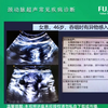 2025-1-3颈动脉超声常见疾病诊断-邢英琦 教授