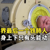 世界最后一个铁肺人，在“铁桶”里生活70年，如今怎么样了