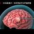 3D动画演示：如何用放疗治疗脑肿瘤